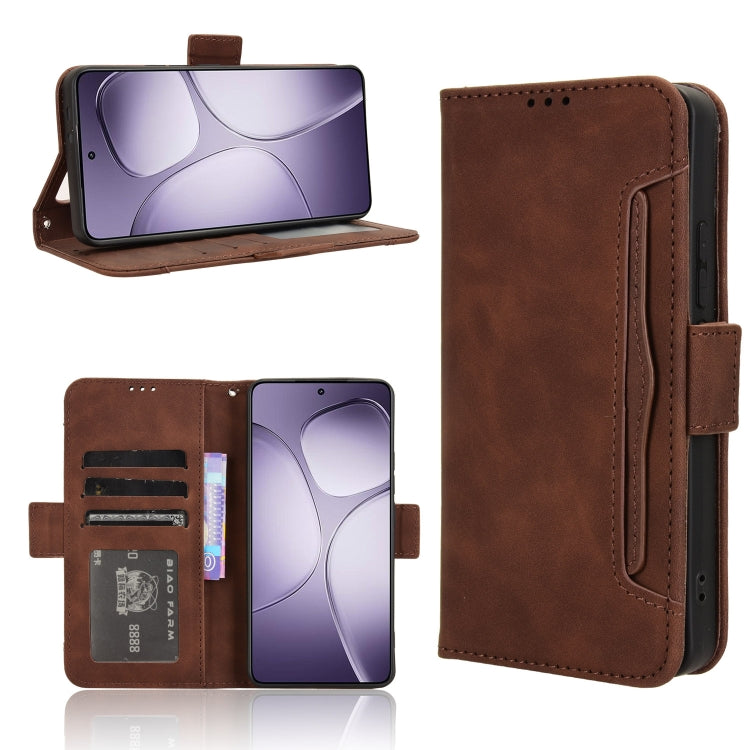 Skin Feel Calf Texture Card Slots Leather Phone Case, For Redmi K70 Ultra, For Redmi 13 4G / Note 13R 5G
