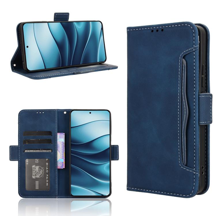 Skin Feel Calf Texture Card Slots Leather Phone Case, For Redmi K80 Ultra, For Redmi A5 4G 173.3mm, For Redmi Note 14 4G 164.84mm EU Version, For Redmi Turbo 4 Pro 5G, For Redmi K80 / K80 Pro, For Redmi Note 14 Pro 4G, For Redmi Note 14 4G Global 163.2...