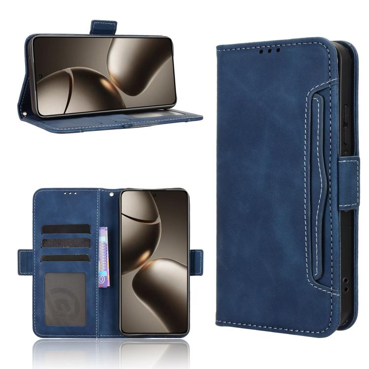Skin Feel Calf Texture Card Slots Leather Phone Case, For Xiaomi 15T Pro 5G, For Xiaomi 15T 5G, For Redmi K80 Ultra, For Redmi A5 4G 173.3mm, For Redmi Note 14 4G 164.84mm EU Version, For Redmi Turbo 4 Pro 5G, For Redmi K80 / K80 Pro                   ...