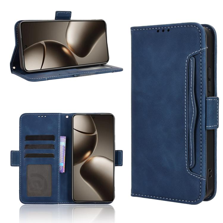 Skin Feel Calf Texture Card Slots Leather Phone Case, For Xiaomi 15T Pro 5G, For Xiaomi 15T 5G, For Redmi K80 Ultra, For Redmi A5 4G 173.3mm, For Redmi Note 14 4G 164.84mm EU Version, For Redmi Turbo 4 Pro 5G, For Redmi K80 / K80 Pro                   ...