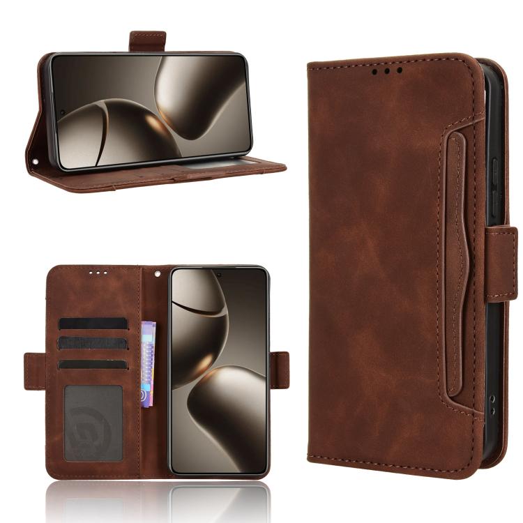 Skin Feel Calf Texture Card Slots Leather Phone Case, For Xiaomi 15T Pro 5G, For Xiaomi 15T 5G, For Redmi K80 Ultra, For Redmi A5 4G 173.3mm, For Redmi Note 14 4G 164.84mm EU Version, For Redmi Turbo 4 Pro 5G, For Redmi K80 / K80 Pro                   ...