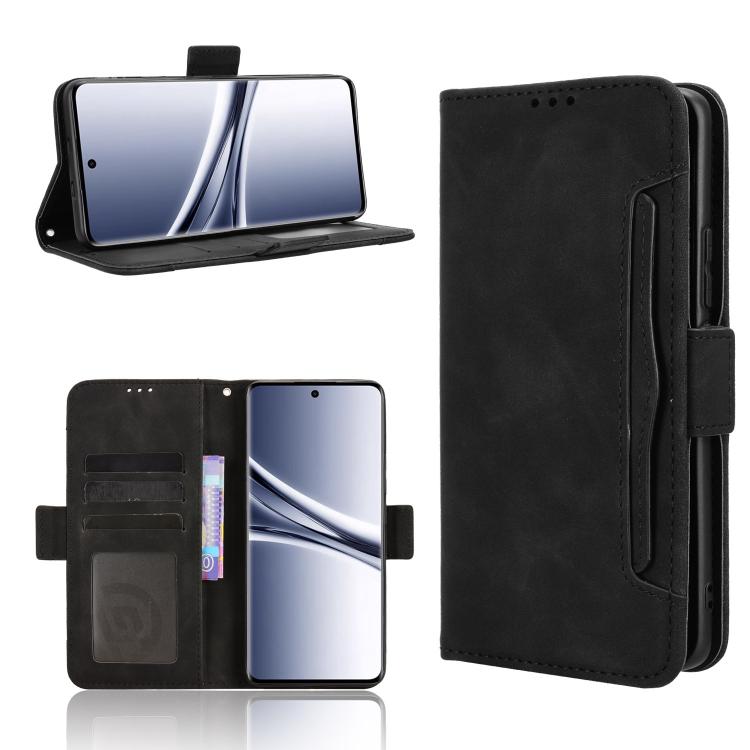Skin Feel Calf Texture Card Slots Leather Phone Case, For Redmi A7 Pro 171mm / Poco C85x 5G, For Redmi Turbo 5 Max 5G / Poco X8 Pro Max, For Redmi Turbo 5 5G / Poco X8 Pro, For Redmi Note 15 Pro+ 5G 163.3mm/Poco M8 Pro 5G                               ...